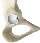 Hip Labral Tear