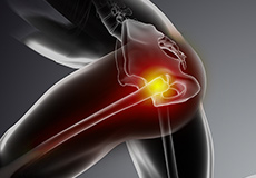 Physical Therapy for Hip